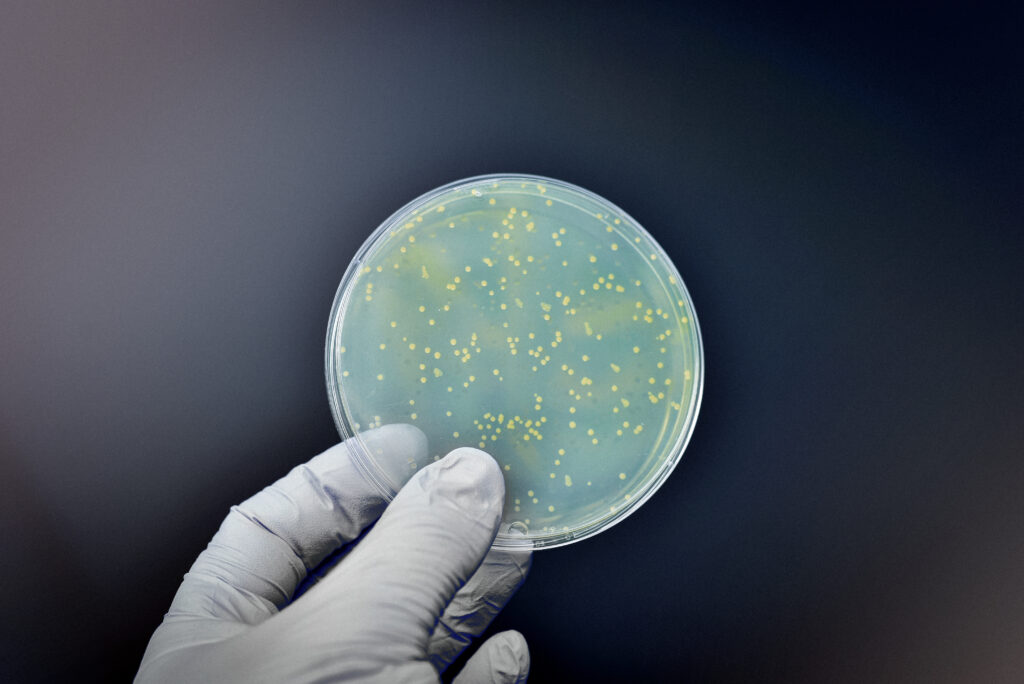 Bacterial culture plate against black background